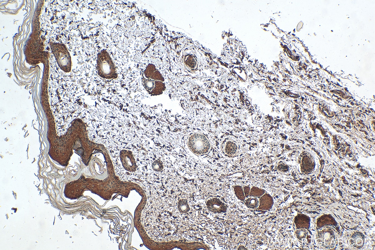 Immunohistochemistry (IHC) staining of rat skin tissue using Cytokeratin 1-specific Polyclonal antibody (16848-1-AP)