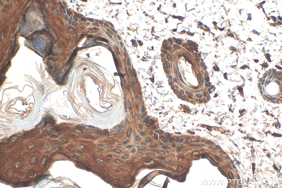 Immunohistochemistry (IHC) staining of rat skin tissue using Cytokeratin 1-specific Polyclonal antibody (16848-1-AP)