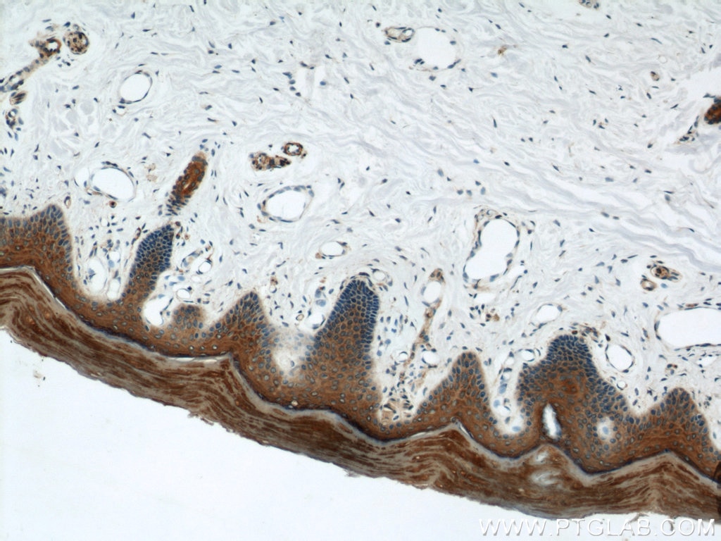 Immunohistochemistry (IHC) staining of human skin tissue using Cytokeratin 1-specific Polyclonal antibody (16848-1-AP)