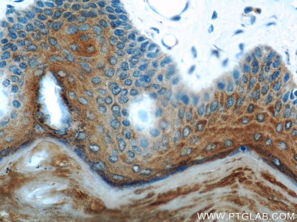 Immunohistochemistry (IHC) staining of human skin tissue using Cytokeratin 1-specific Polyclonal antibody (16848-1-AP)