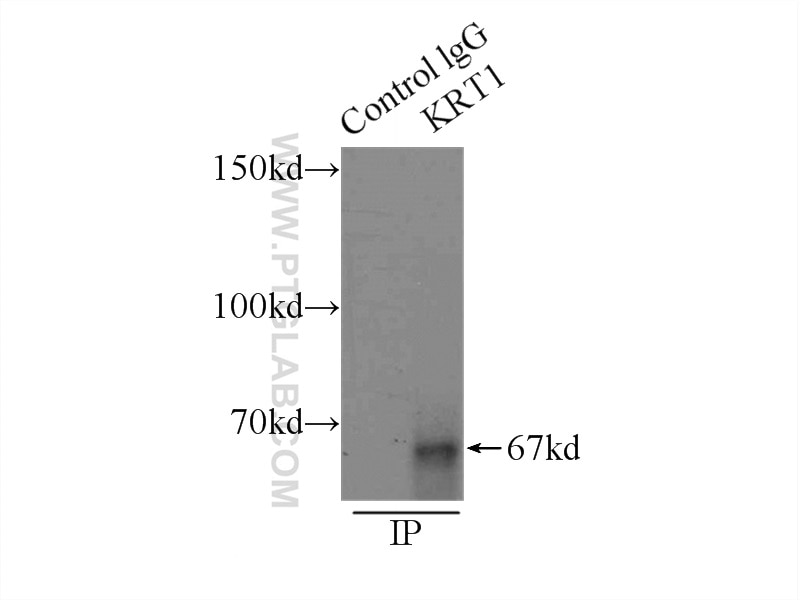 Immunoprecipitation (IP) experiment of A431 cells using Cytokeratin 1-specific Polyclonal antibody (16848-1-AP)