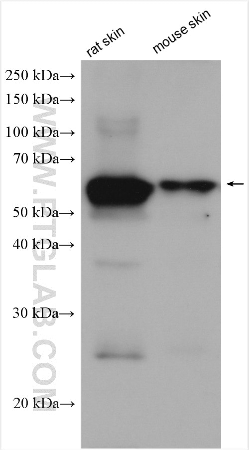 Western Blot (WB) analysis of various lysates using Cytokeratin 1-specific Polyclonal antibody (16848-1-AP)