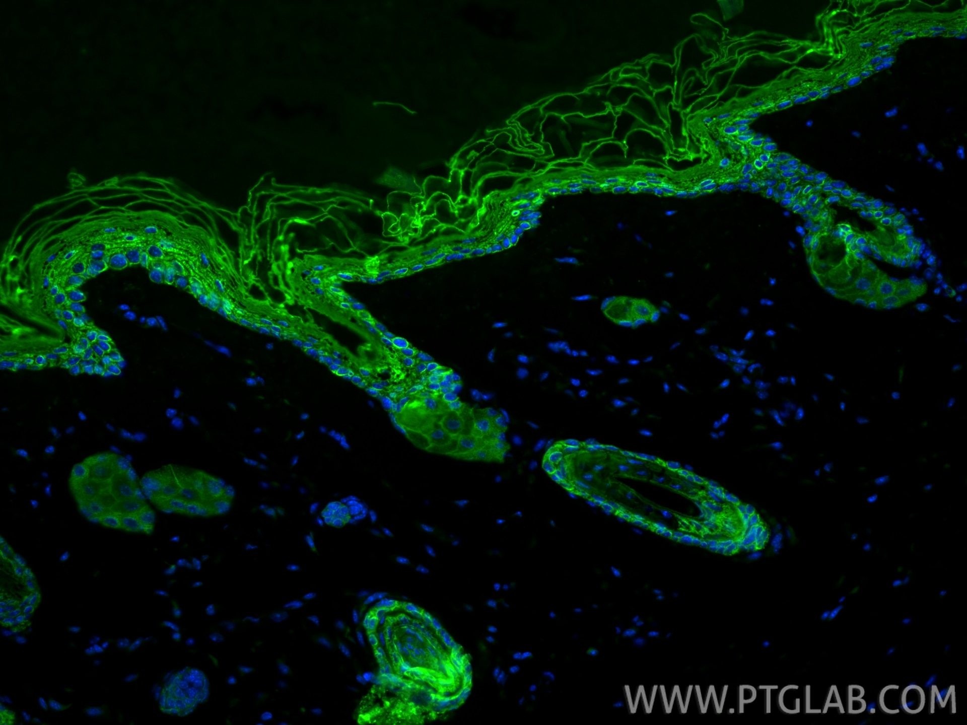 Immunofluorescence (IF) / fluorescent staining of mouse skin tissue using Cytokeratin 10 Polyclonal antibody (18343-1-AP)