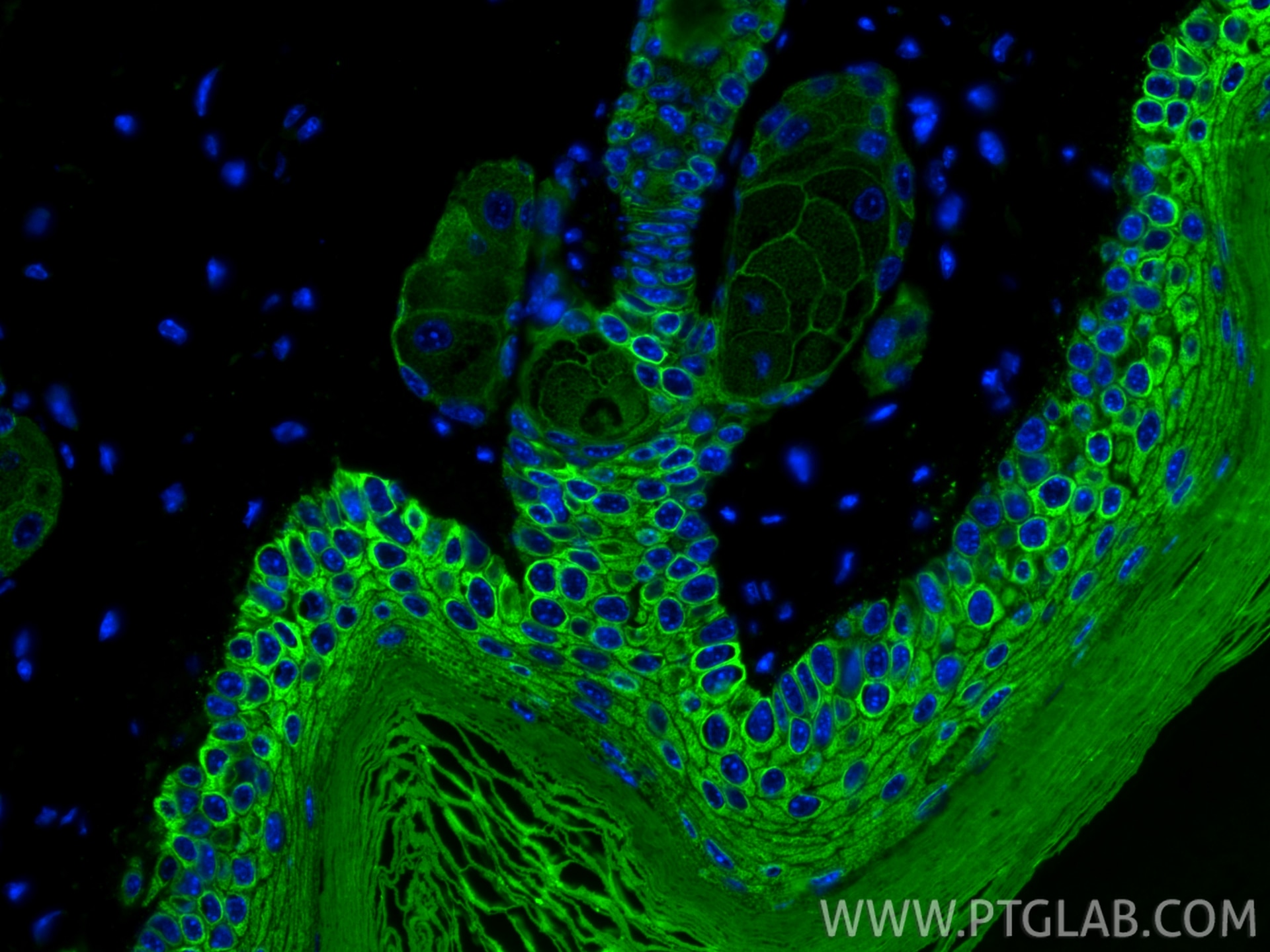 Immunofluorescence (IF) / fluorescent staining of mouse skin tissue using Cytokeratin 10 Polyclonal antibody (18343-1-AP)