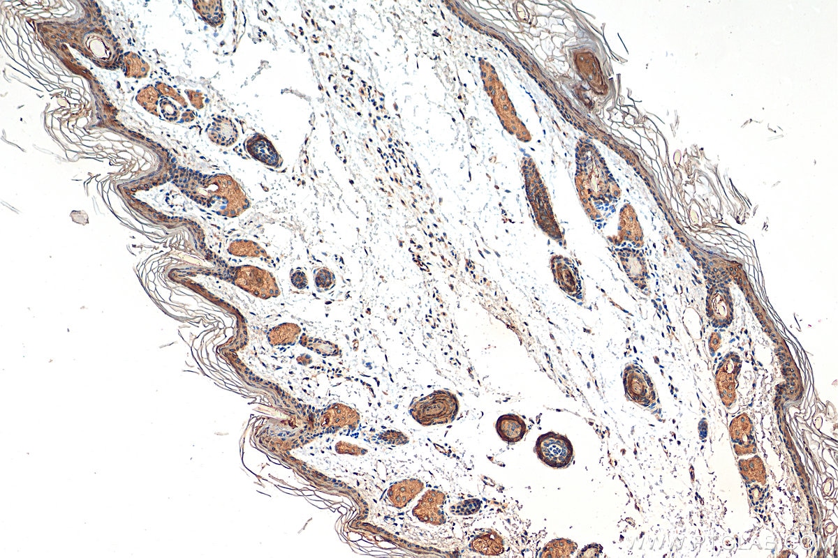 Immunohistochemistry (IHC) staining of mouse skin tissue using Cytokeratin 10 Polyclonal antibody (18343-1-AP)