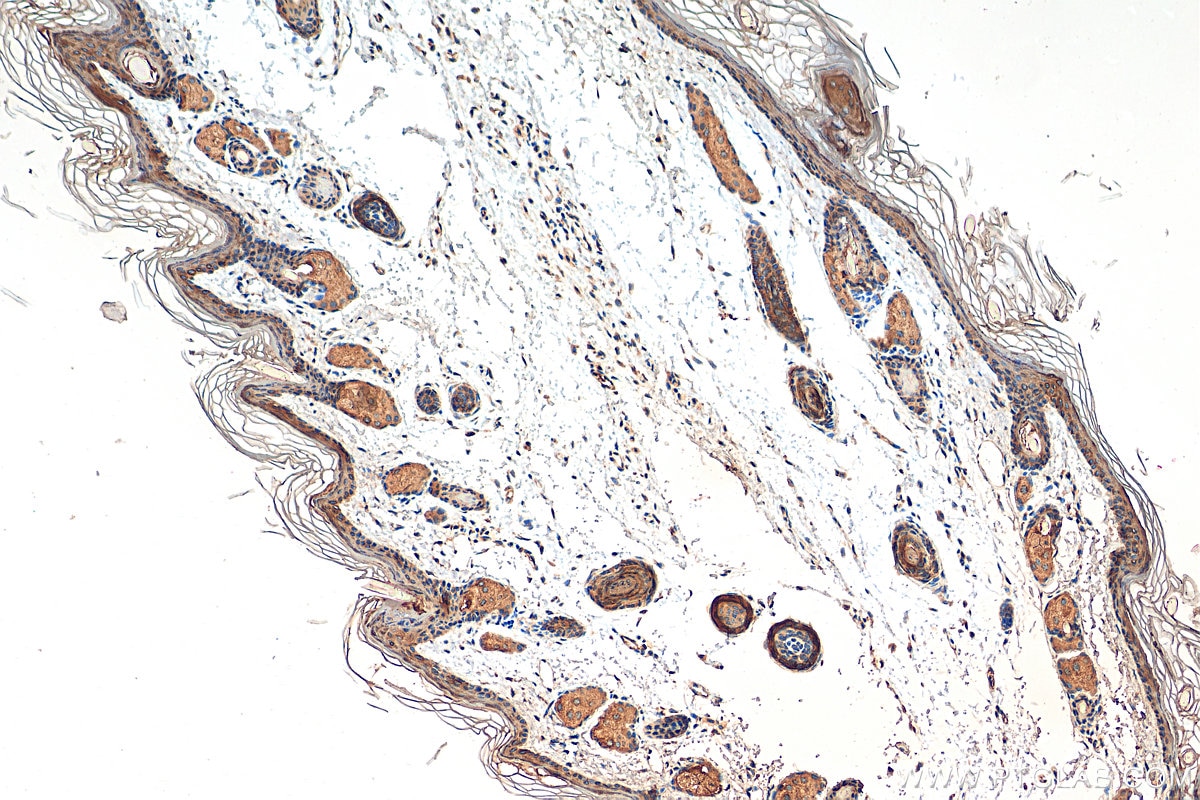 IHC staining of mouse skin using 18343-1-AP