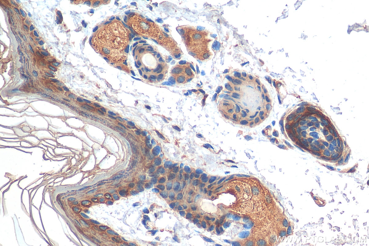 Immunohistochemistry (IHC) staining of mouse skin tissue using Cytokeratin 10 Polyclonal antibody (18343-1-AP)