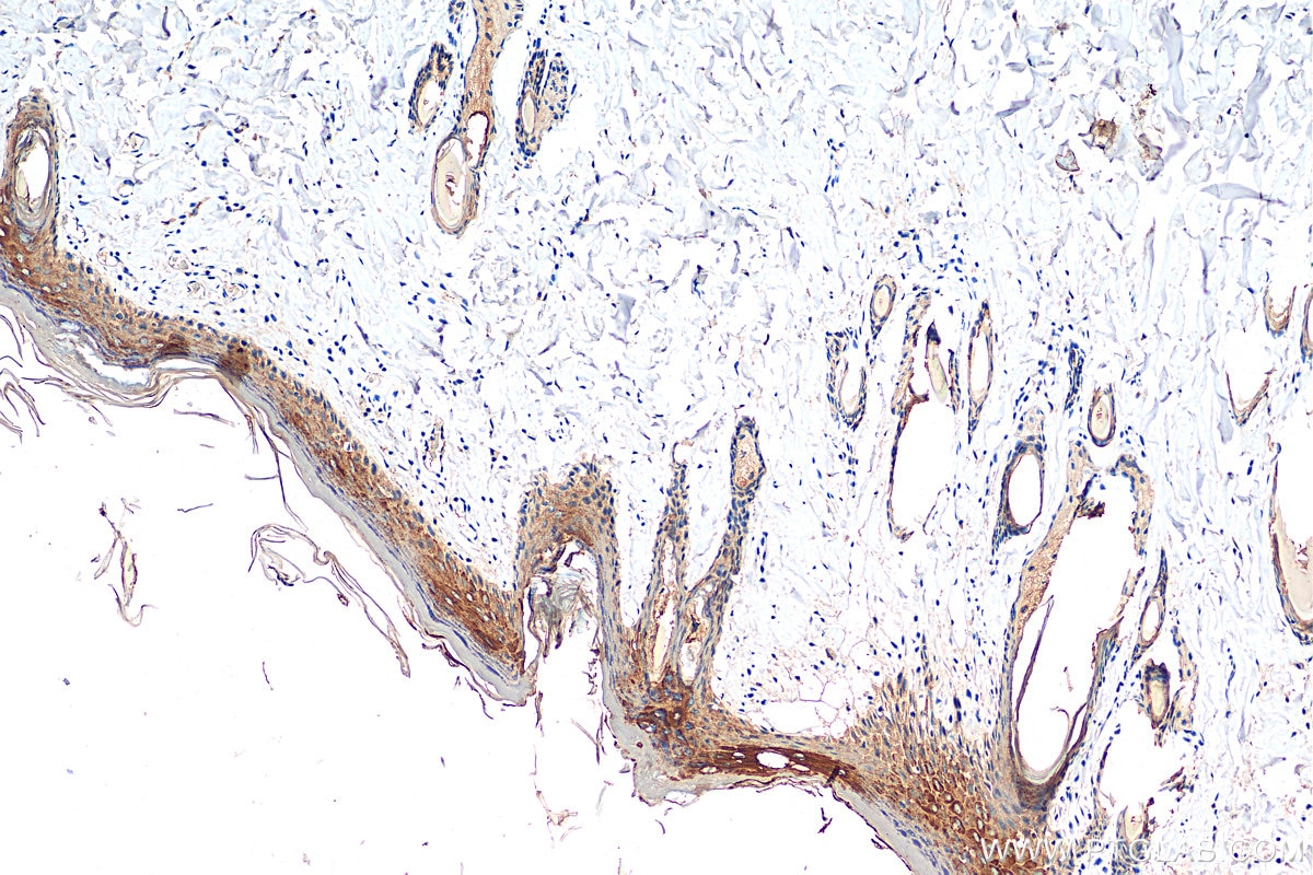 IHC staining of rat skin using 18343-1-AP