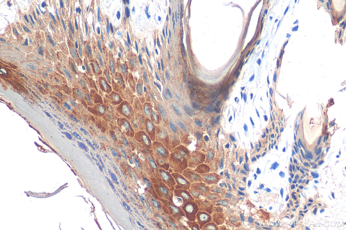 Immunohistochemistry (IHC) staining of rat skin tissue using Cytokeratin 10 Polyclonal antibody (18343-1-AP)
