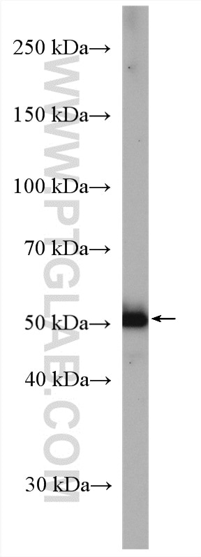 Western Blot (WB) analysis of A431 cells using Cytokeratin 10 Polyclonal antibody (18343-1-AP)