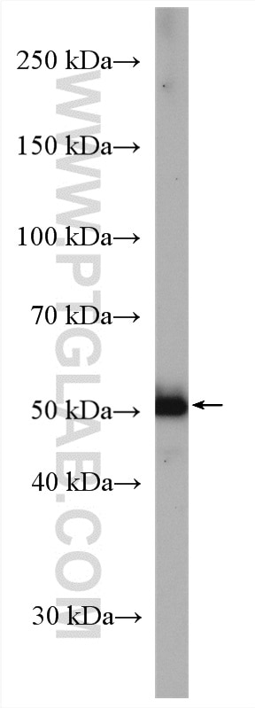 WB analysis of A431 using 18343-1-AP