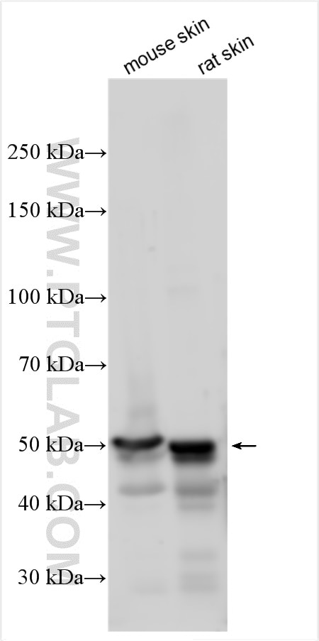 Western Blot (WB) analysis of various lysates using Cytokeratin 10 Polyclonal antibody (18343-1-AP)