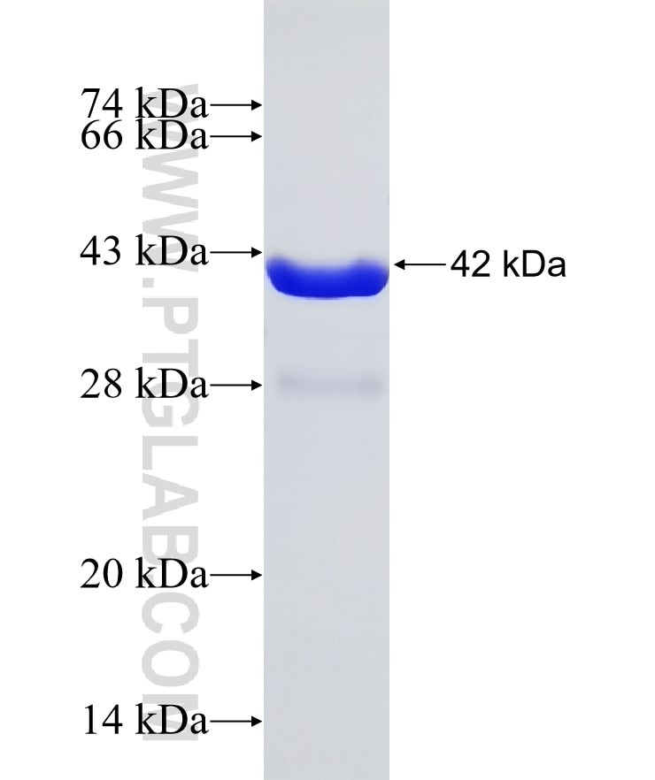 KRT10 fusion protein Ag32344 SDS-PAGE KRT10 fusion protein Ag32344 SDS-PAGE
