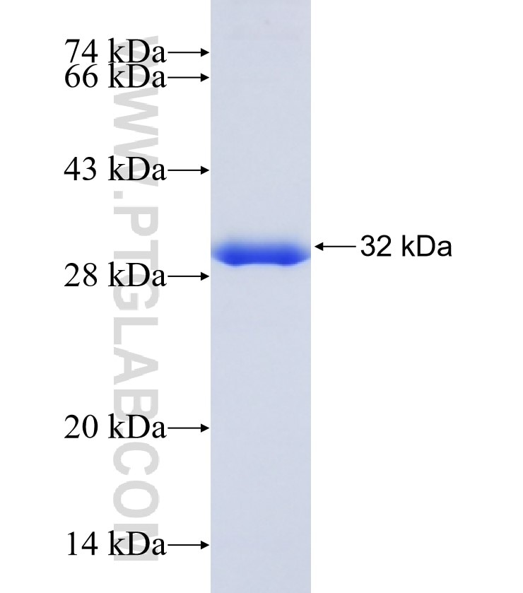 KRT10 fusion protein Ag12729 SDS-PAGE