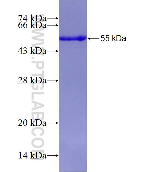 KRT10 fusion protein Ag13136 SDS-PAGE