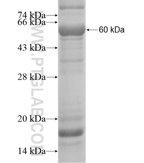 KRT10 fusion protein Ag20209 SDS-PAGE