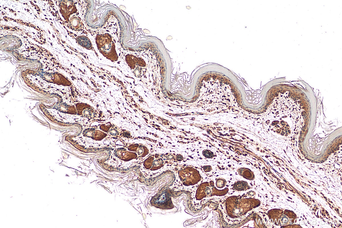 Immunohistochemistry (IHC) staining of mouse skin tissue using Cytokeratin 10-specific Polyclonal antibody (16855-1-AP)
