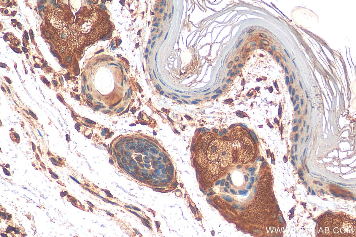 Immunohistochemistry (IHC) staining of mouse skin tissue using Cytokeratin 10-specific Polyclonal antibody (16855-1-AP)