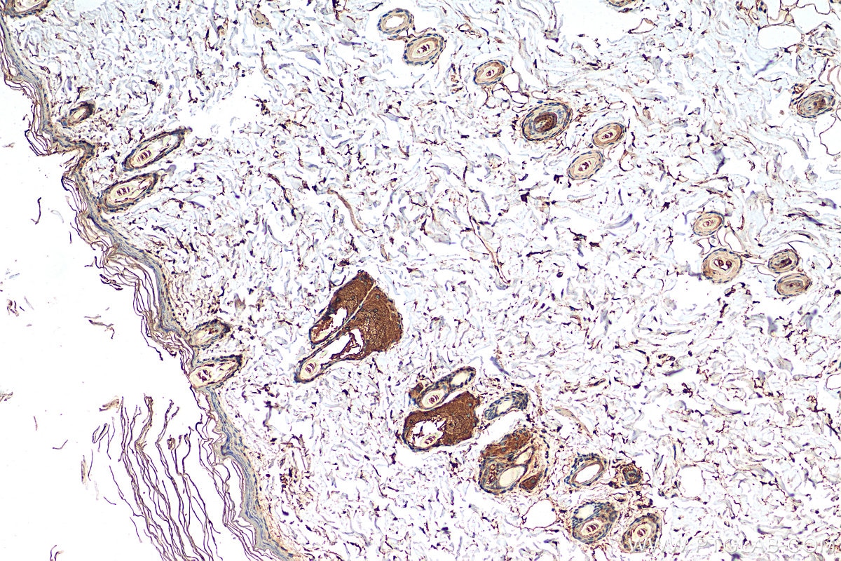 Immunohistochemistry (IHC) staining of rat skin tissue using Cytokeratin 10-specific Polyclonal antibody (16855-1-AP)