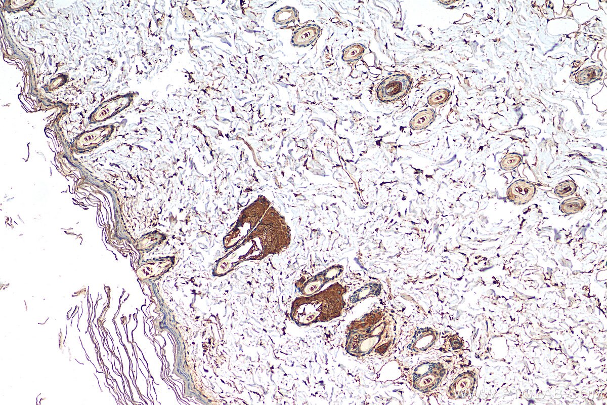 IHC staining of rat skin using 16855-1-AP