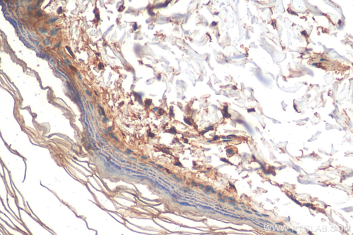 Immunohistochemistry (IHC) staining of rat skin tissue using Cytokeratin 10-specific Polyclonal antibody (16855-1-AP)