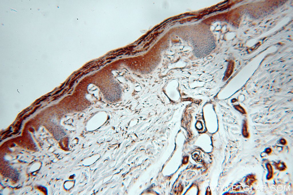 Cytokeratin 10-specific