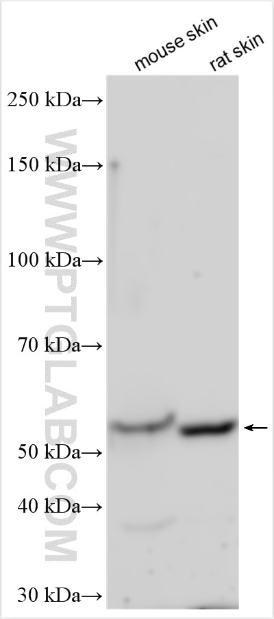 Western Blot (WB) analysis of various lysates using Cytokeratin 10-specific Polyclonal antibody (16855-1-AP)