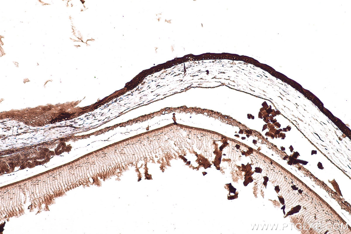 Immunohistochemistry (IHC) staining of mouse eye tissue using KRT12 Polyclonal antibody (24789-1-AP)