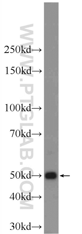 Western Blot (WB) analysis of mouse eye tissue using KRT12 Polyclonal antibody (24789-1-AP)