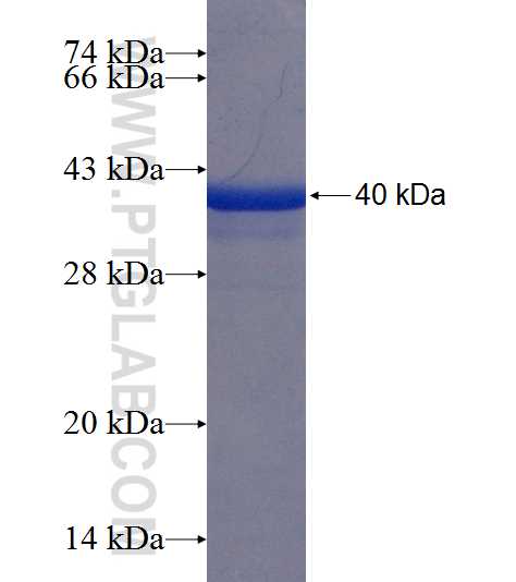 KRT12 fusion protein Ag20312 SDS-PAGE