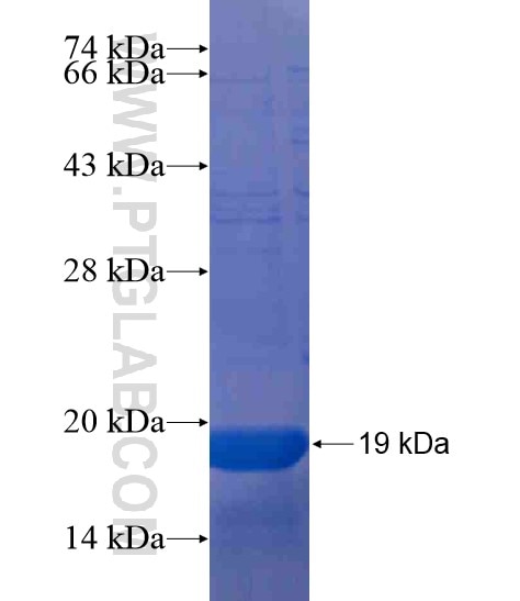KRT12 fusion protein Ag20332 SDS-PAGE