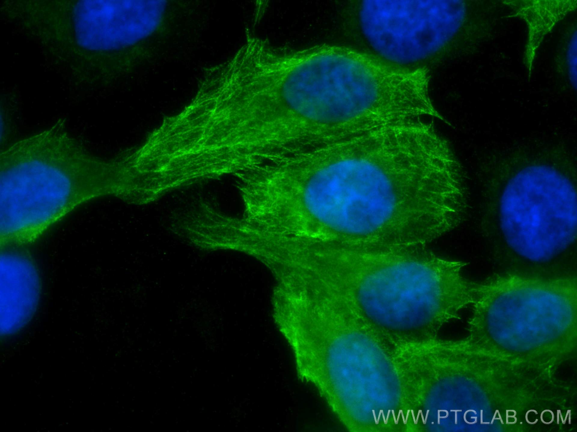 Immunofluorescence (IF) / fluorescent staining of A431 cells using Cytokeratin 13 Polyclonal antibody (10164-2-AP)