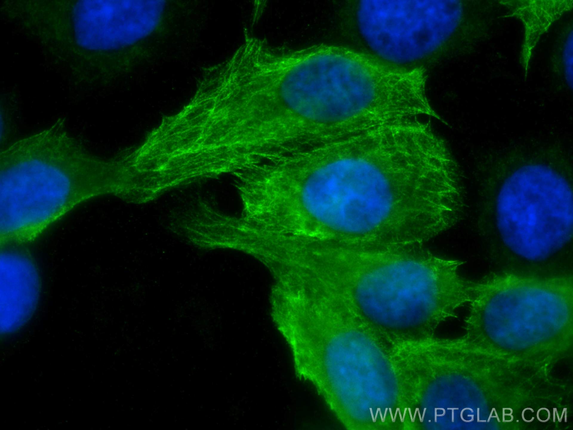 IF Staining of A431 using 10164-2-AP