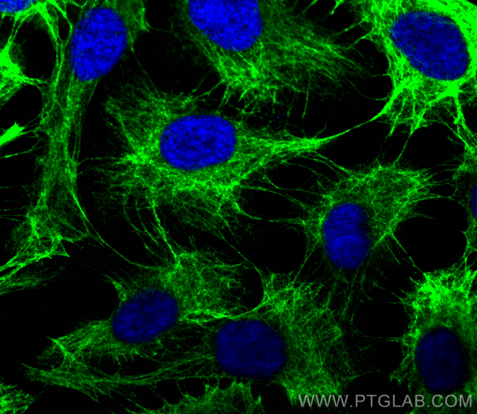 Immunofluorescence (IF) / fluorescent staining of HaCaT cells using Cytokeratin 13 Polyclonal antibody (10164-2-AP)