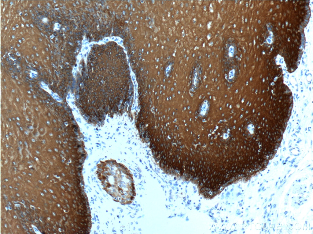 Immunohistochemistry (IHC) staining of human oesophagus tissue using Cytokeratin 13 Polyclonal antibody (10164-2-AP)