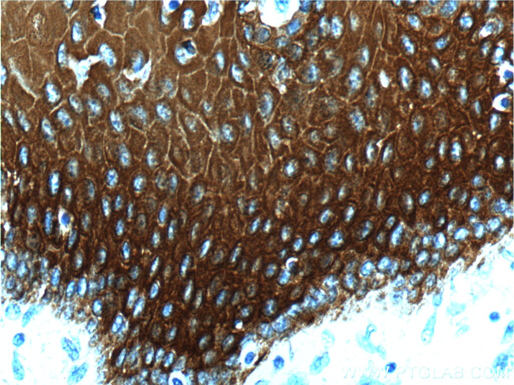 IHC staining of human oesophagus using 10164-2-AP