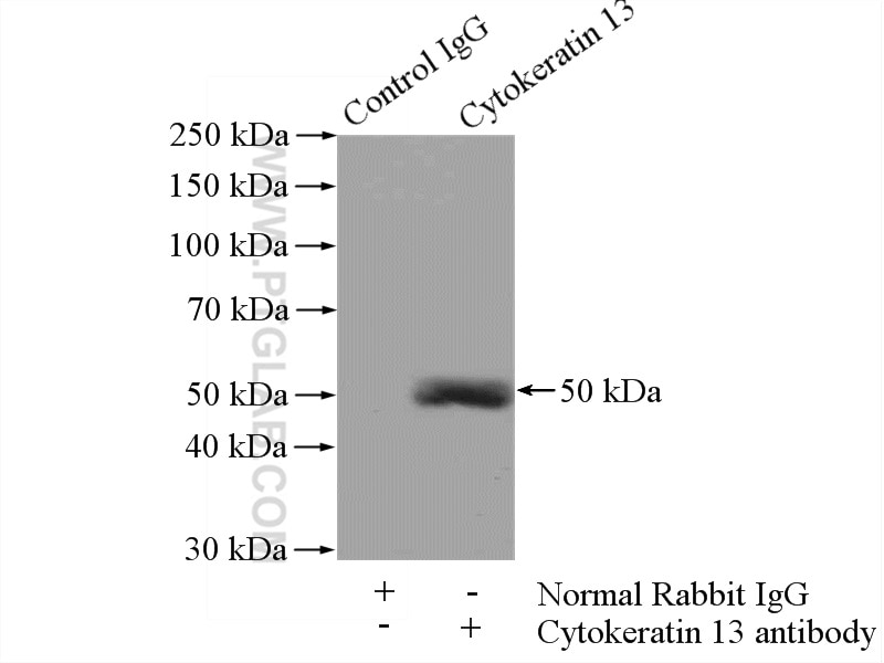 Immunoprecipitation (IP) experiment of A431 cells using Cytokeratin 13 Polyclonal antibody (10164-2-AP)