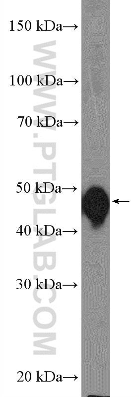 Western Blot (WB) analysis of A431 cells using Cytokeratin 13 Polyclonal antibody (10164-2-AP)