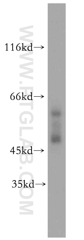 Western Blot (WB) analysis of mouse skin tissue using Cytokeratin 13 Polyclonal antibody (10164-2-AP)