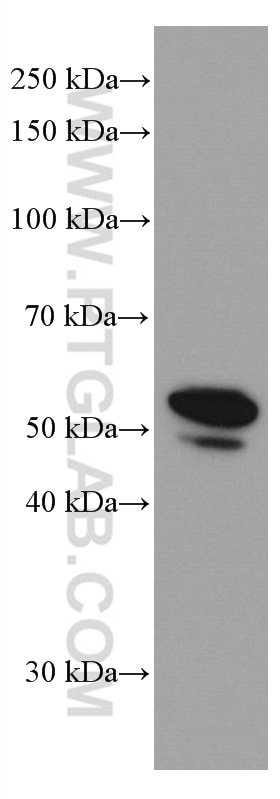 Western Blot (WB) analysis of A431 cells using Cytokeratin 13 Monoclonal antibody (66684-1-Ig)