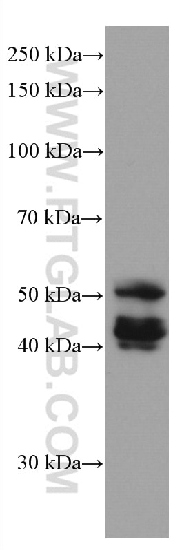 Western Blot (WB) analysis of rat skin tissue using Cytokeratin 13 Monoclonal antibody (66684-1-Ig)