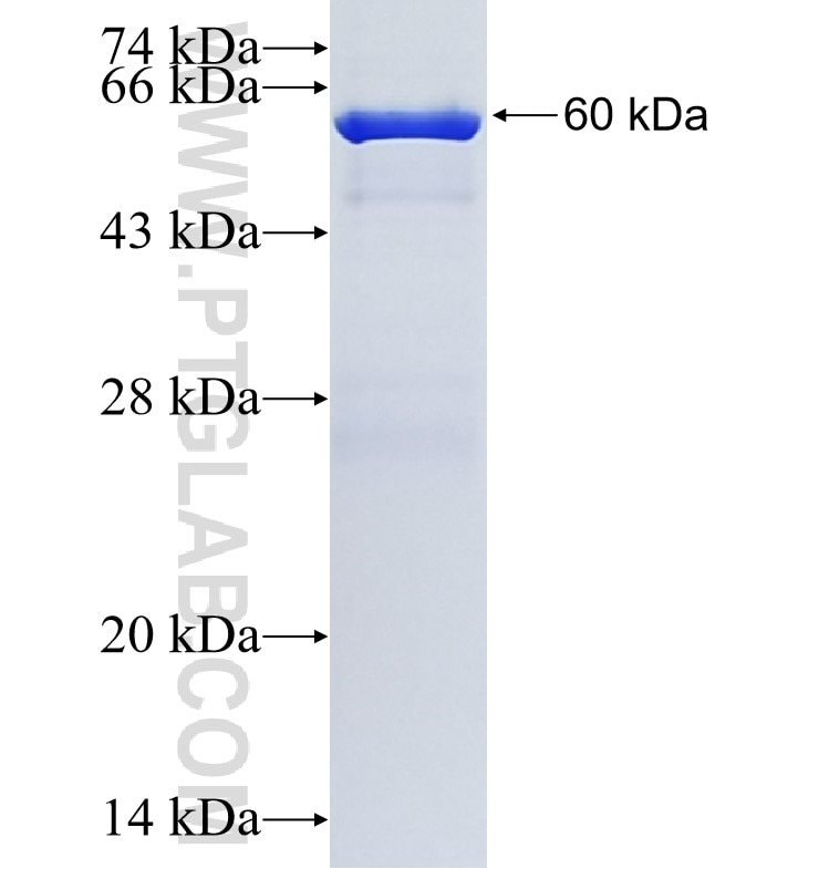 KRT13 fusion protein Ag0217 SDS-PAGE