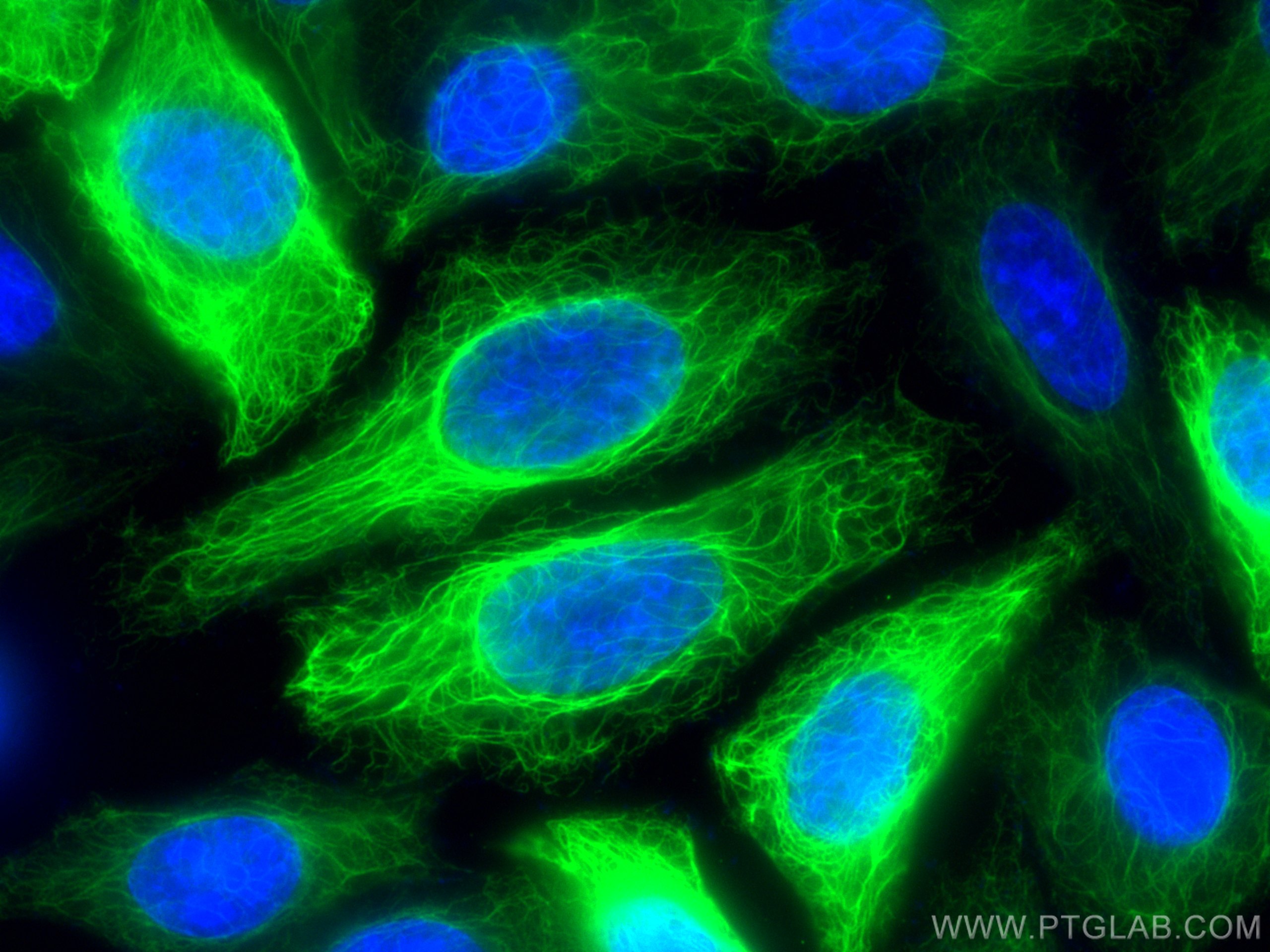Immunofluorescence (IF) / fluorescent staining of HepG2 cells using Cytokeratin 14 Polyclonal antibody (10143-1-AP)