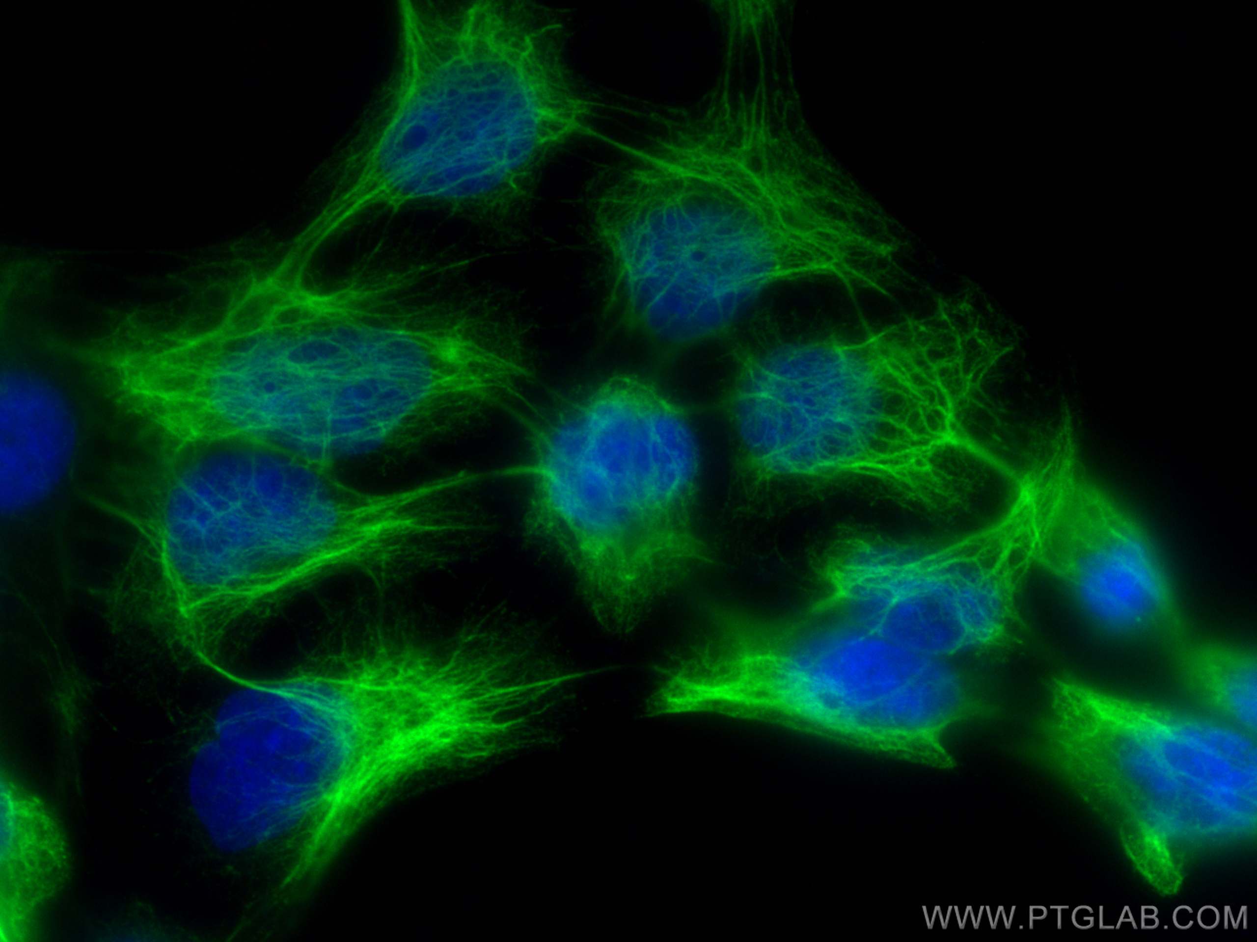 Immunofluorescence (IF) / fluorescent staining of HaCaT cells using Cytokeratin 14 Polyclonal antibody (10143-1-AP)