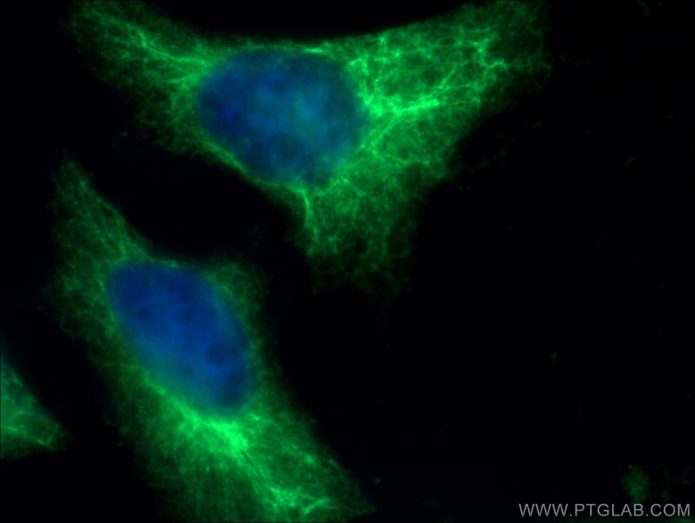 Immunofluorescence (IF) / fluorescent staining of HeLa cells using Cytokeratin 14 Polyclonal antibody (10143-1-AP)
