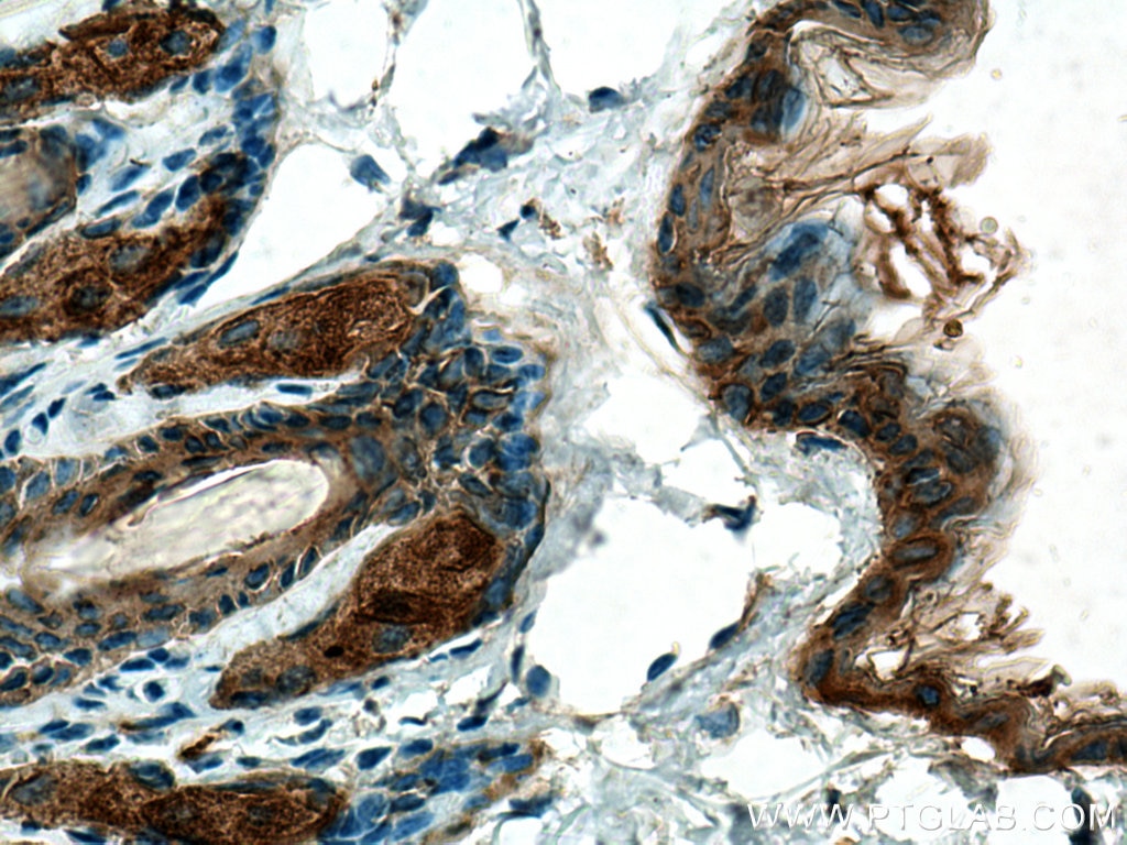 IHC staining of mouse skin using 10143-1-AP