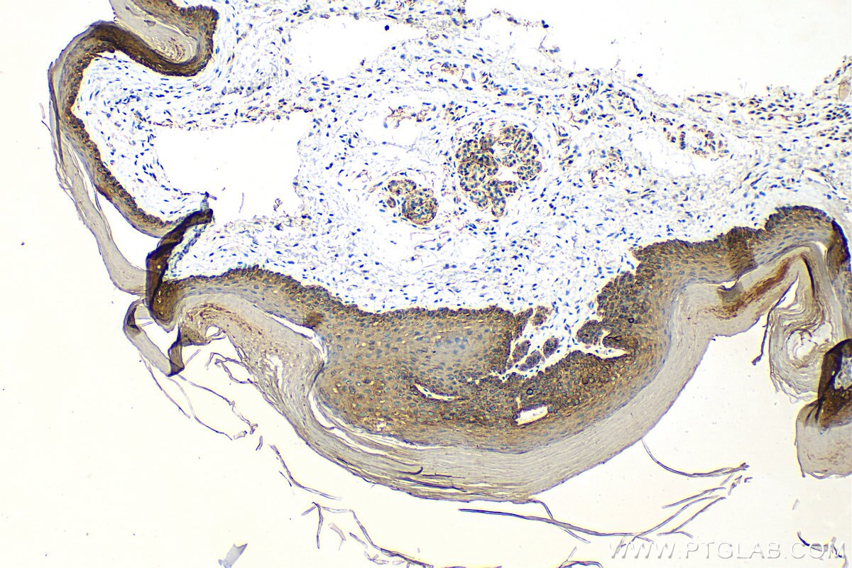 Immunohistochemistry (IHC) staining of mouse skin tissue using Cytokeratin 14 Polyclonal antibody (10143-1-AP)