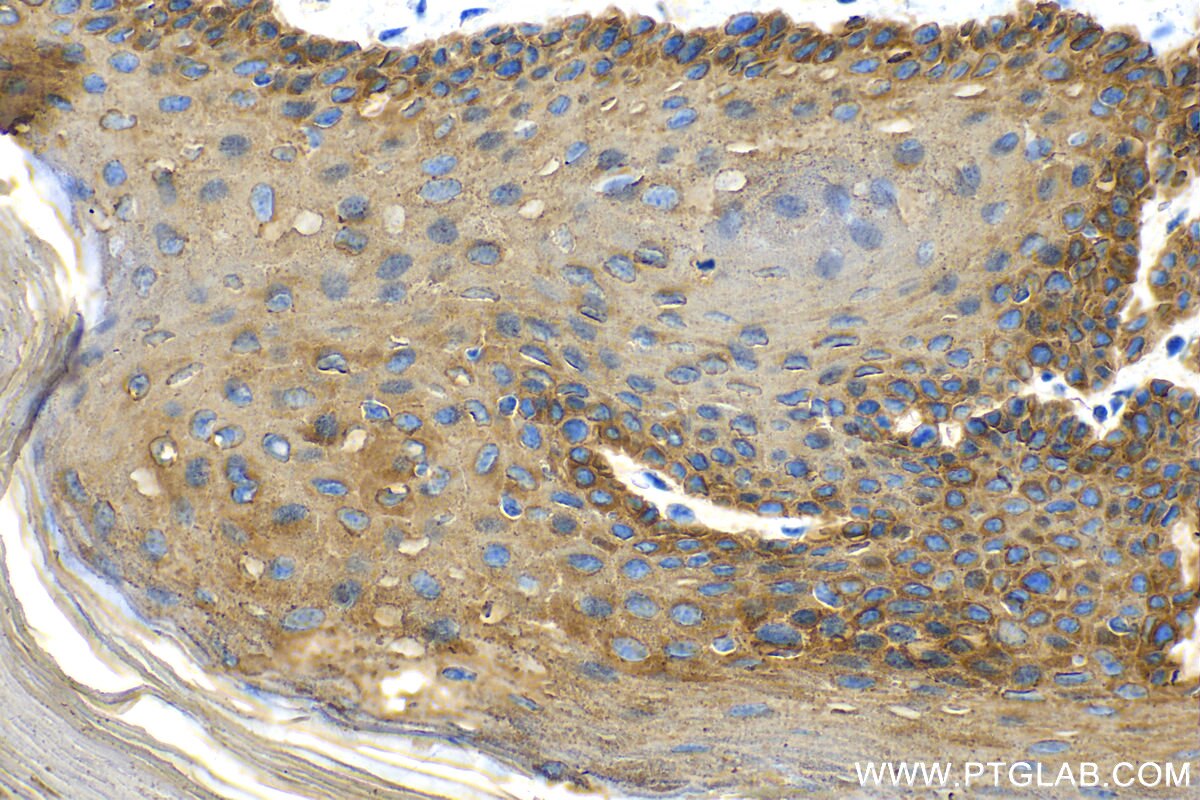 Immunohistochemistry (IHC) staining of mouse skin tissue using Cytokeratin 14 Polyclonal antibody (10143-1-AP)