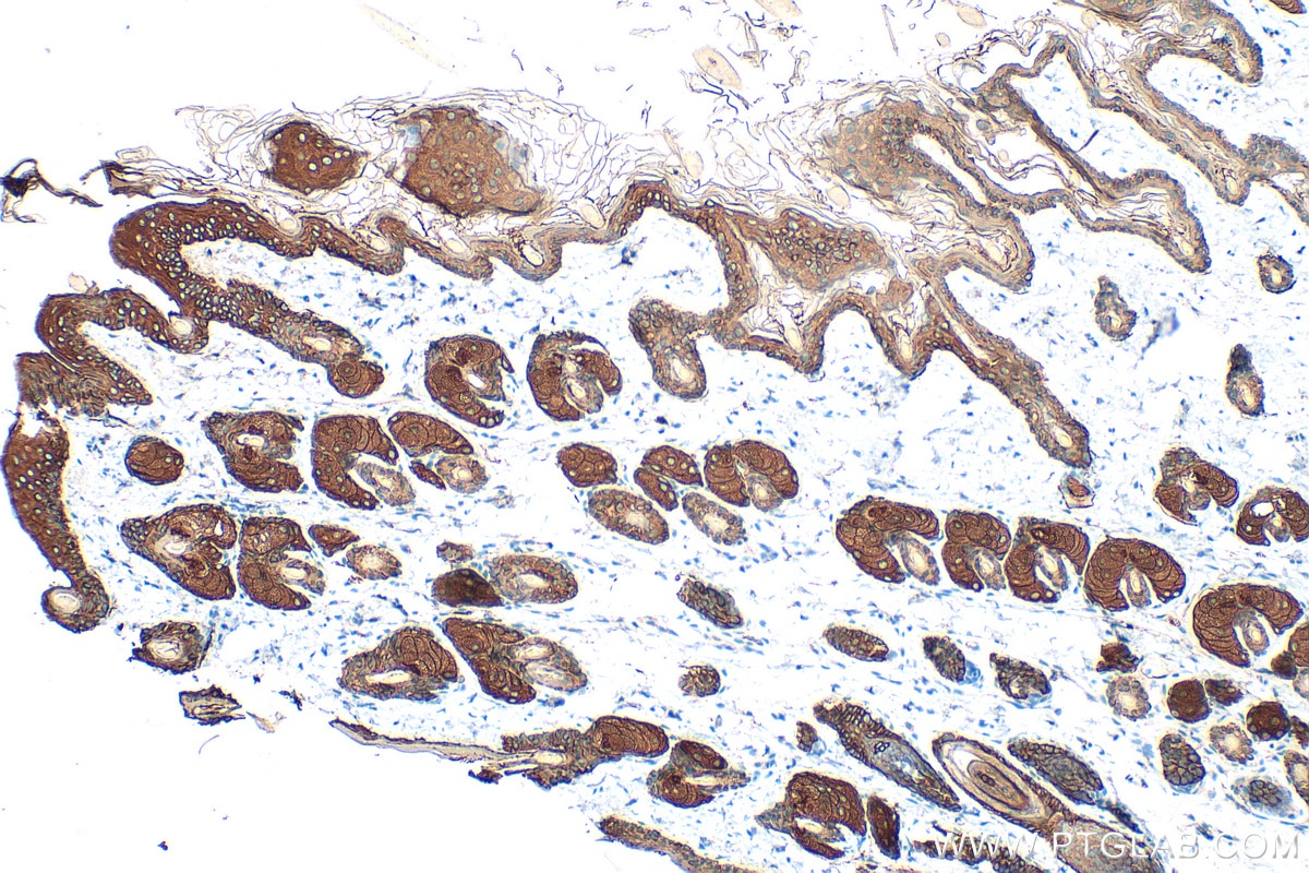 Immunohistochemistry (IHC) staining of mouse skin tissue using Cytokeratin 14 Polyclonal antibody (10143-1-AP)