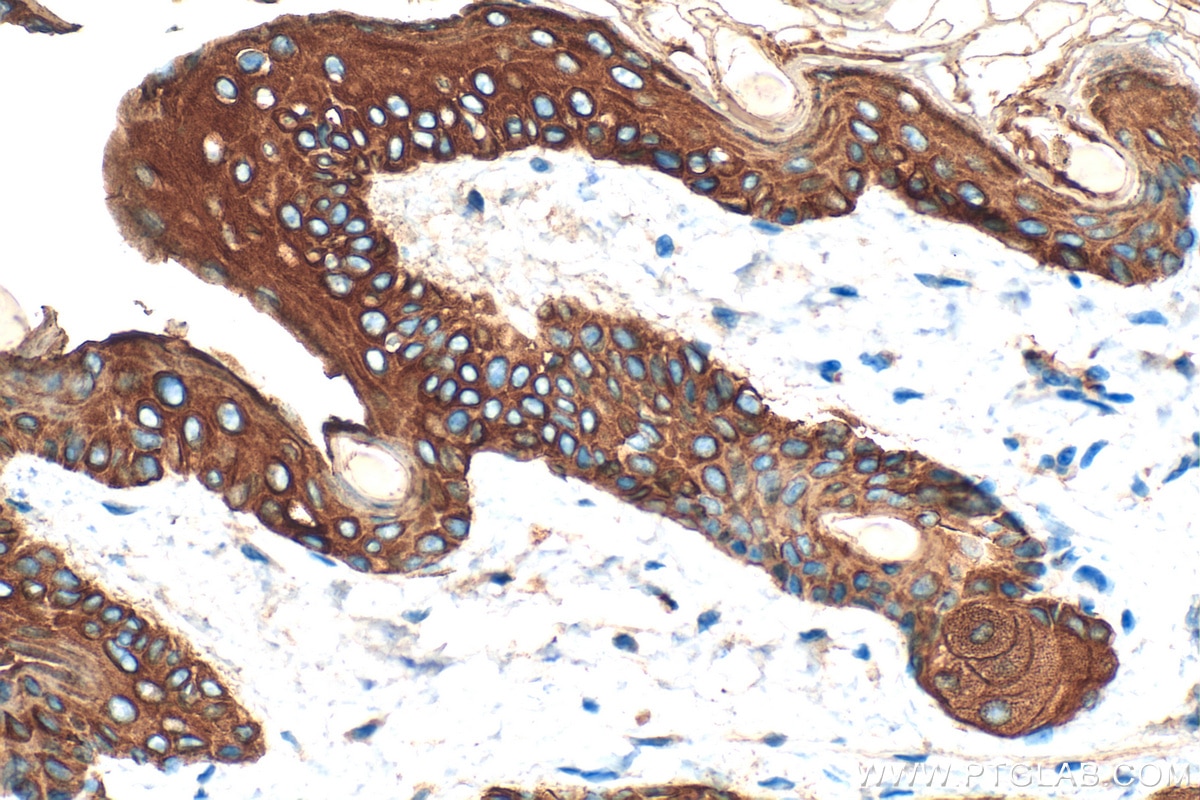 Immunohistochemistry (IHC) staining of mouse skin tissue using Cytokeratin 14 Polyclonal antibody (10143-1-AP)